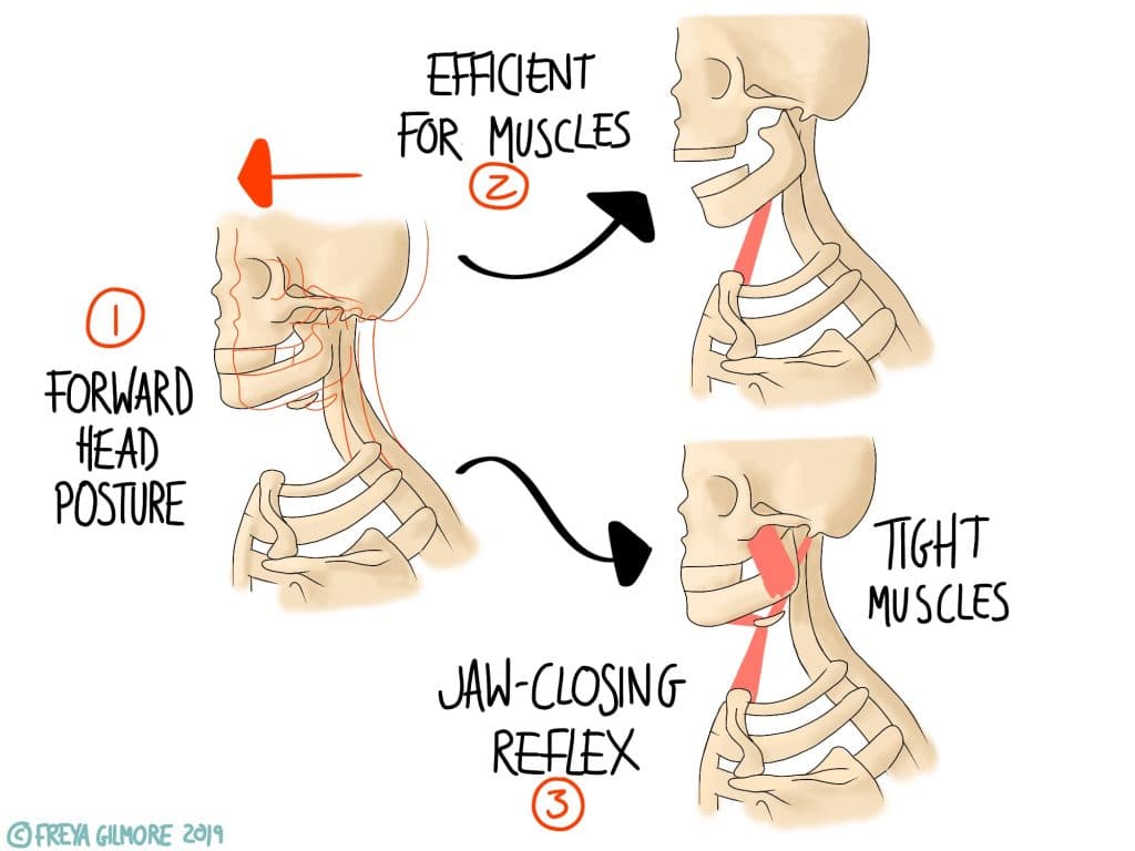 The effects of tension on head position and the jaw

