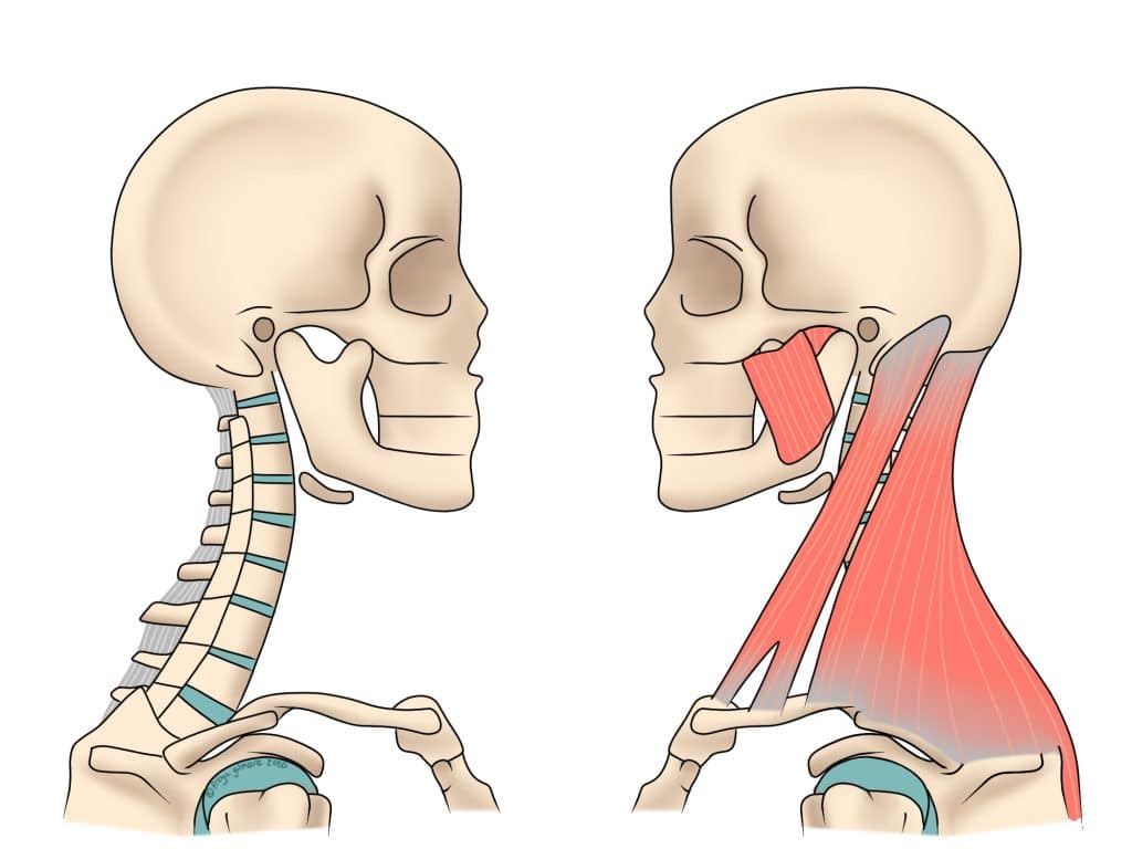 Neck pain: muscles, joints, discs, and ligaments commonly involved